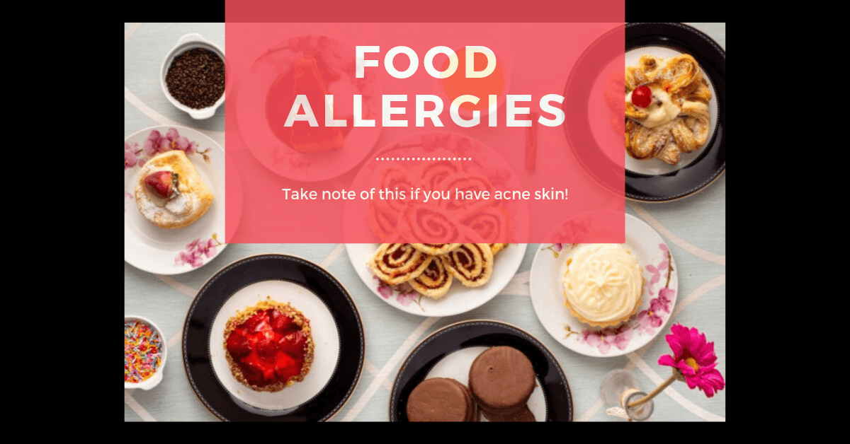 Identify the source of food allergies that cause