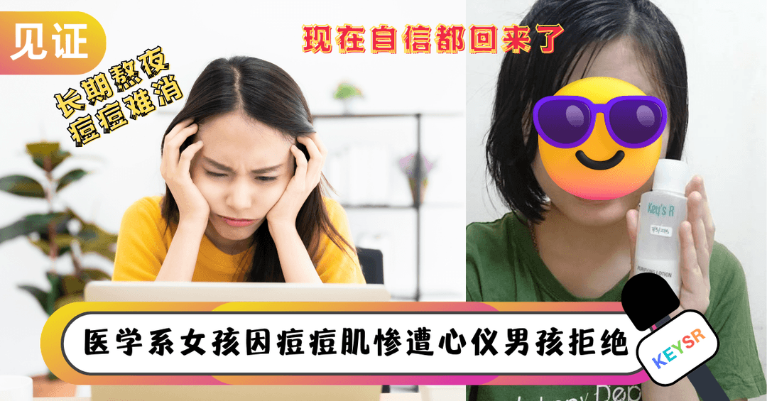 谢谢你拯救了我的痘痘脸！给Key's R的一封信